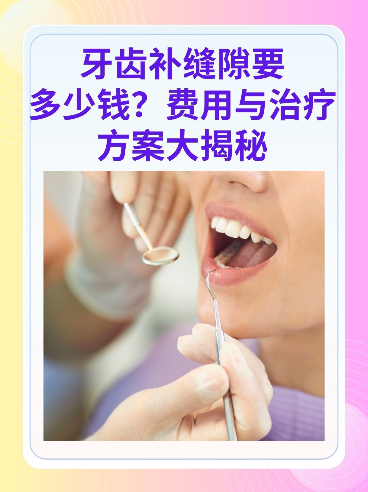 呼和浩特补牙医保可以报销吗(补牙医保可以报销吗 哪些可以报销呢)